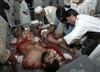 تصویر تلفات انفجارهای بغداد به 63 نفر افزایش یافت