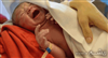 تصویر به دنیا آمدن نوزاد 55 روز بعد از مرگ مادرش! +عکس