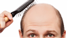 تصویر کشف مکانیزم تاثیرگذار در طاسی و خاکستری شدن مو 