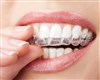 تصویر علت و روش‌های درمانی دندان‌قروچه